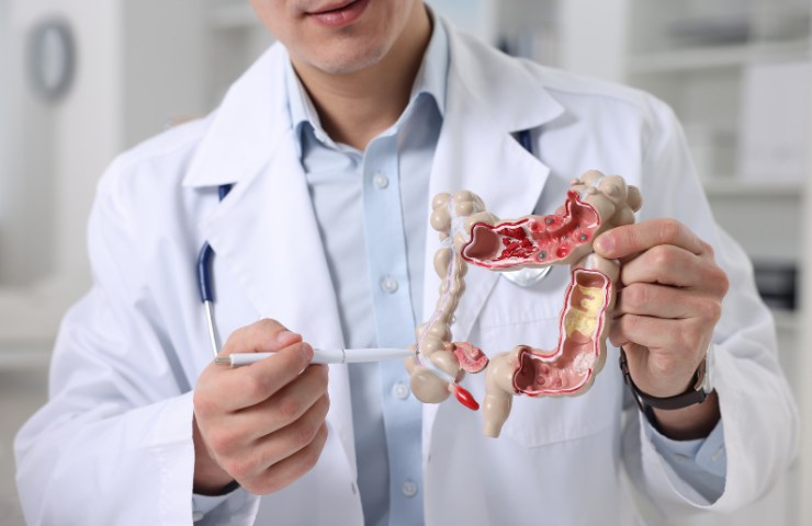 Un gastroenterologo che mostra un modello di intestino